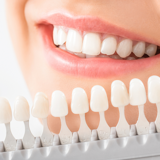 Secretos del Blanqueamiento Dental: ¿Cómo Aclarar tu Sonrisa de Forma Segura en Casa?